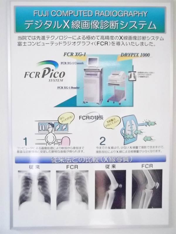 デジタルＸ線画像診断システム